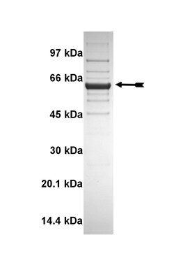 Eurofins DiscoverX DYRK2 Protein, Active 10 &mu;g | Buy Online | Eurofins DiscoverX | Fisher Scientific